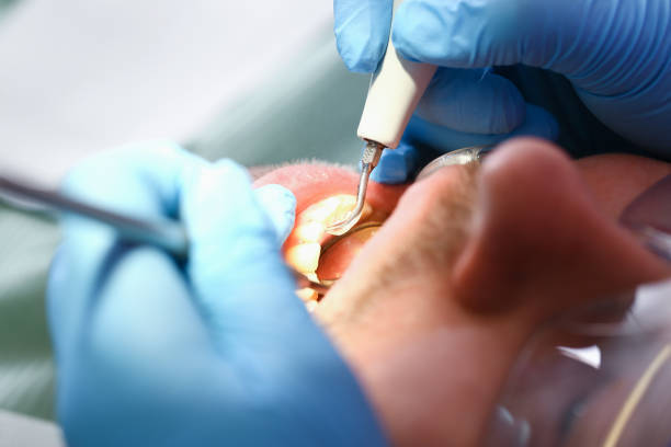 Best Emergency TMJ Treatment in Mcgovern, PA