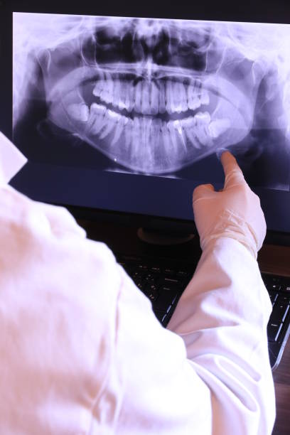 Best Emergency Wisdom Teeth Removal in Mcgovern, PA