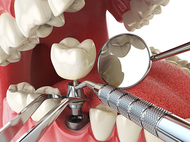 Best Emergency Root Canal Treatment in Mcgovern, PA
