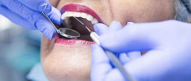 Best Urgent Care for Lost Fillings or Crowns in Mcgovern, PA